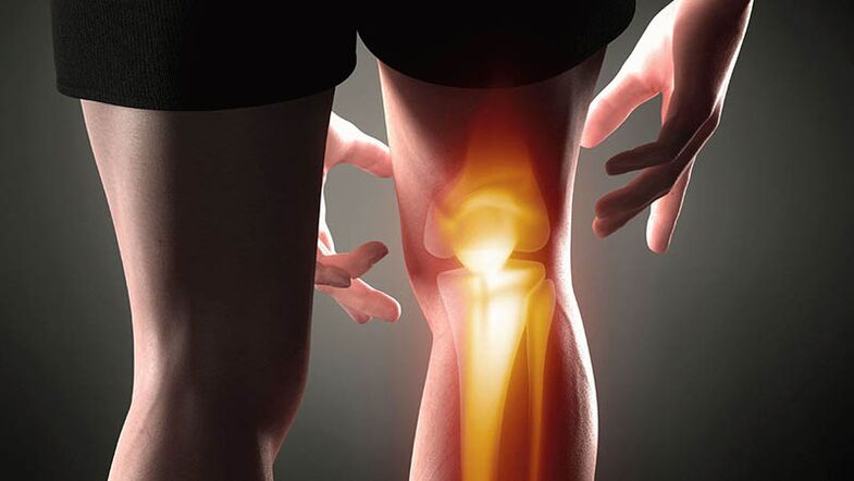 Arthrose des Kniegelenks